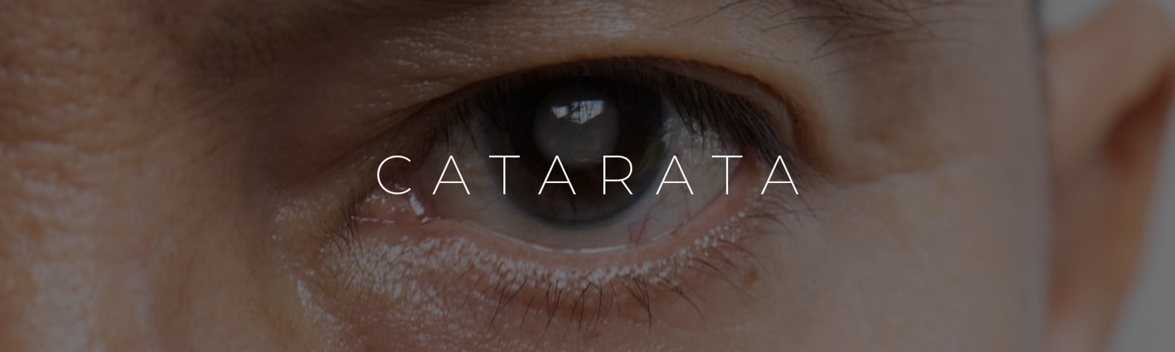 catarata