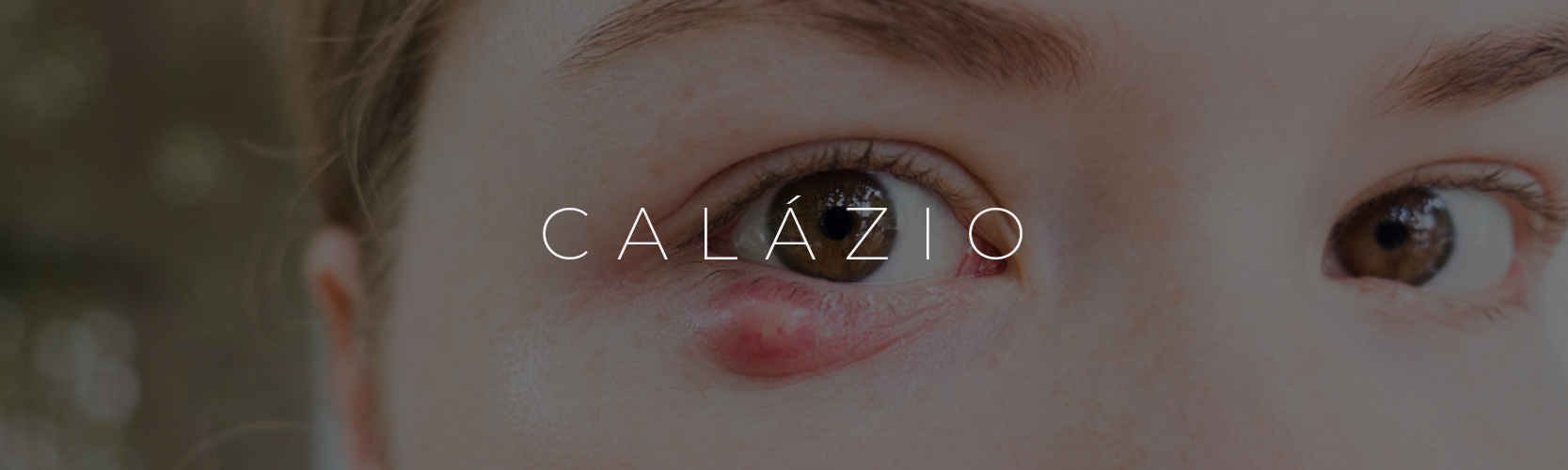 Calázio