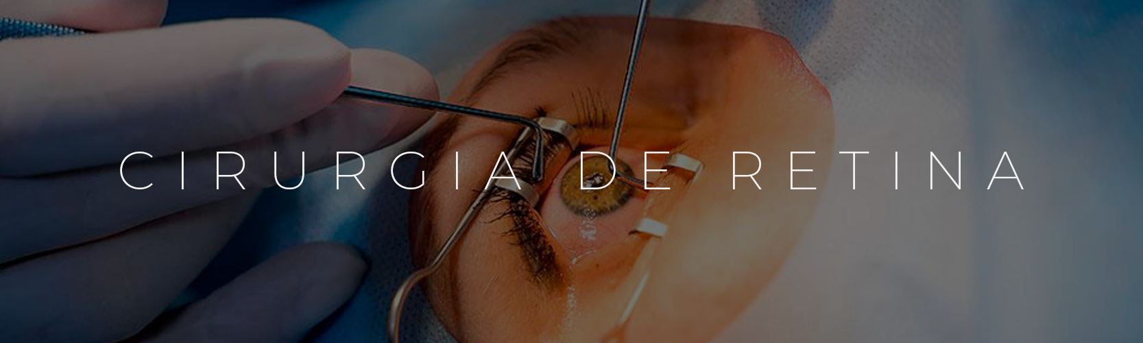 Cirurgia de Retina